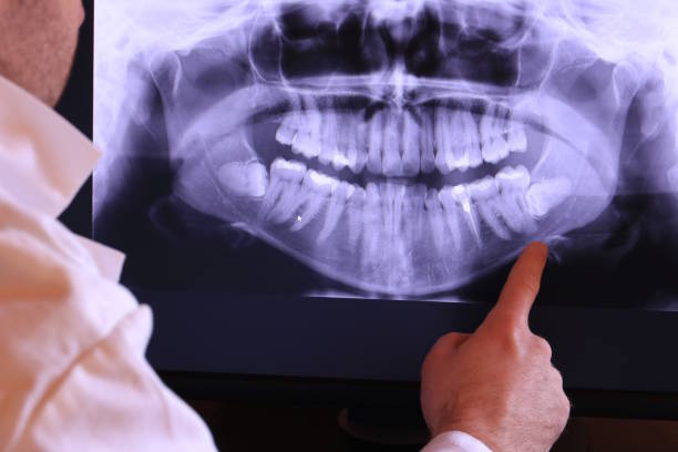 Best Emergency Cosmetic Dentistry in Collierville, CA