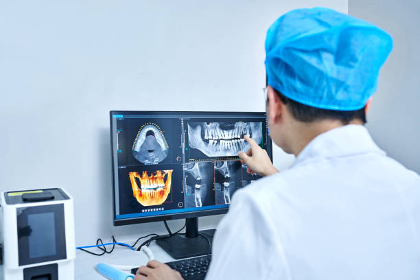 Best Emergency Root Canal Treatment in Collierville, CA